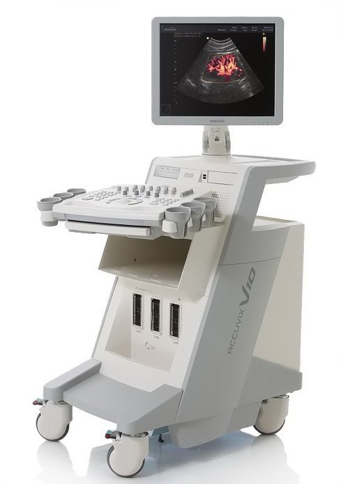 Aparelho de ultrassom para exames obstétricos e ginecológicos