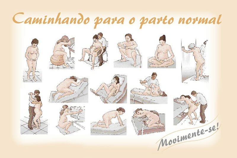Ilustração das etapas do parto normal 