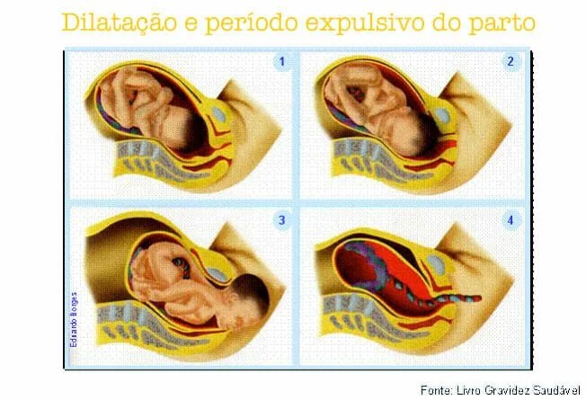 Entenda as etapas do parto normal - Gravidez Saudável